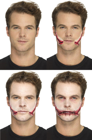 Stitched Smile Prosthetic