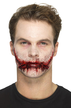 Stitched Smile Prosthetic